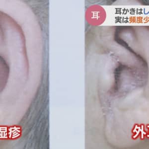 耳掃除はどのくらいの頻度でしますか？