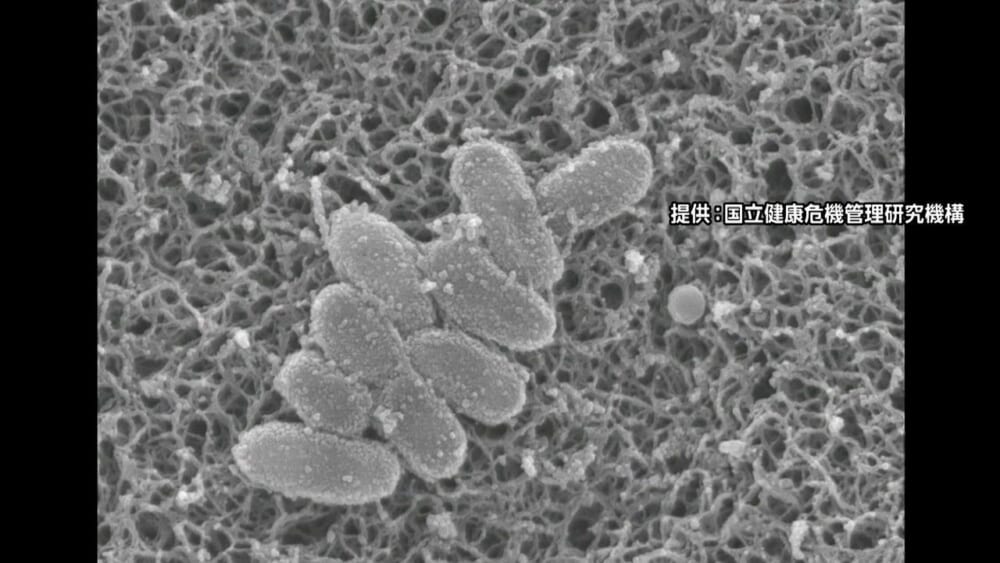 【百日咳の症状】どのようなものを認識してますか？