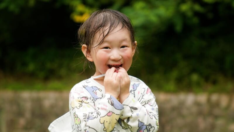 口唇口蓋裂の子 親が見つけた希望