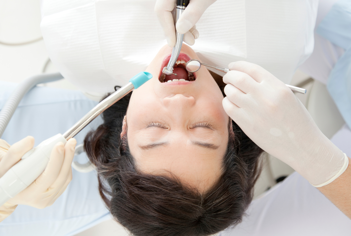 歯の治療中、目は「開けるor閉じる」どっち？現役歯科医にも、正直どう思っているか聞いてみた | kufura（クフラ）小学館公式