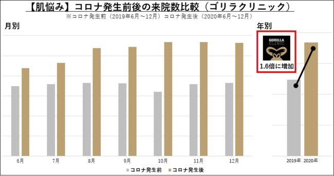 ◆【最新・メンズ美容調査】男性の美意識に “コロナ禍” と “ダイバーシティ” の波／生活様式の変化から「マスク肌荒れ」「オンライン映え」で高まる男性美容ニーズ